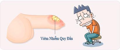 viem-bao-quy-dau-cap-tinh1.jpg