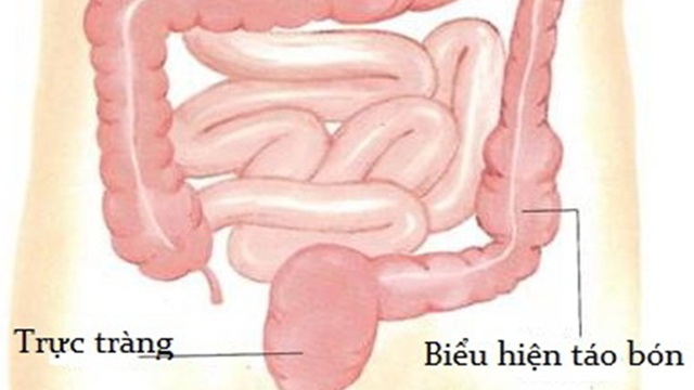 1500684944-a.jpg