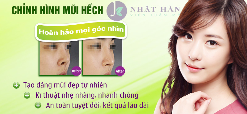 chinh-sua-mui-hech-1.jpg