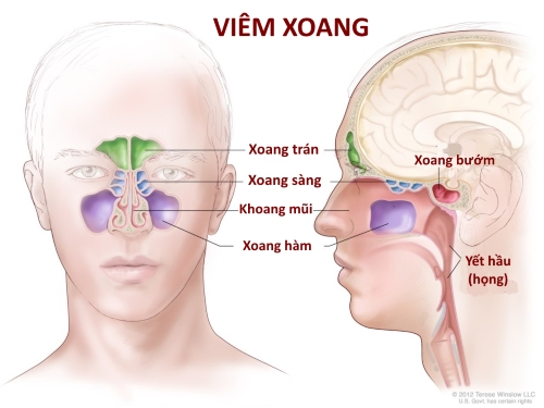 viem-xoang-la-gi.jpg