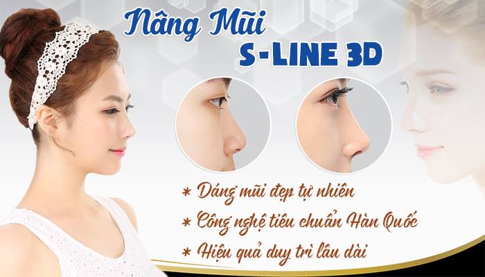 nang-mui-s-line-3d-la-gi-1.jpg