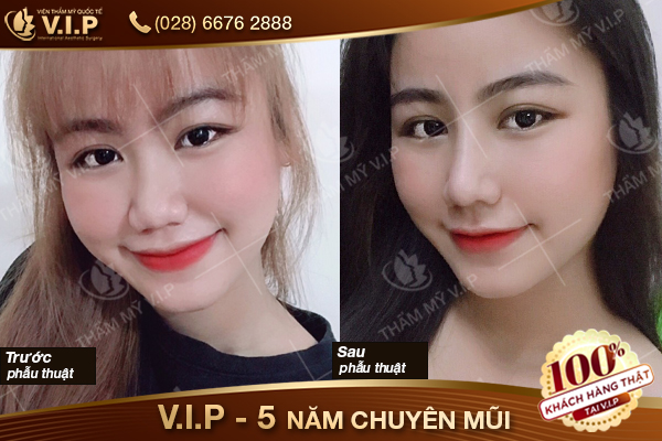khach-hang-nang-mui-t7-18.jpg