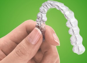 nieng-rang-invisalign-1.jpg