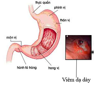 hang%20vi%20da%20day.jpg