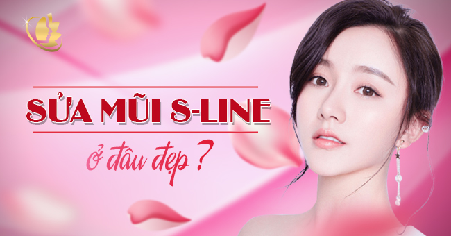 sua-mui-s-line-o-dau-dep.jpg