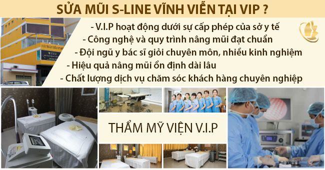 sua-mui-s-line-vinh-vien-o-dau-an-toan.jpg