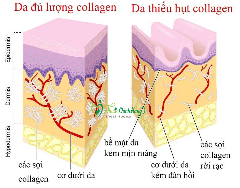 dau-hieu-thieu-collagen.jpg